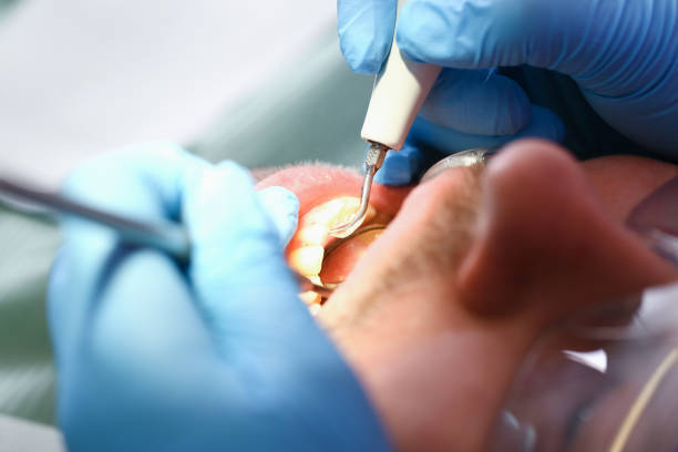 Best Pediatric Emergency Dentist in Green Bay, WI